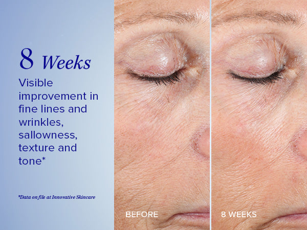 Active Peel System - To-trins botanisk peeling behandling der eksfolierer og fornyer huden for en mere strålende og glat teint