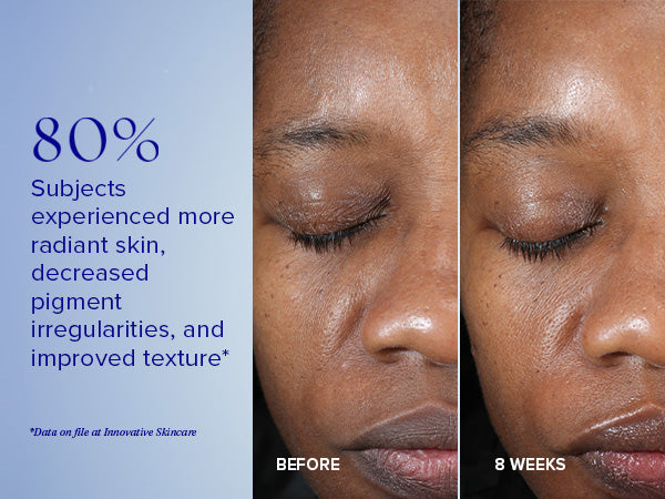 Active Peel System - To-trins botanisk peeling behandling der eksfolierer og fornyer huden for en mere strålende og glat teint