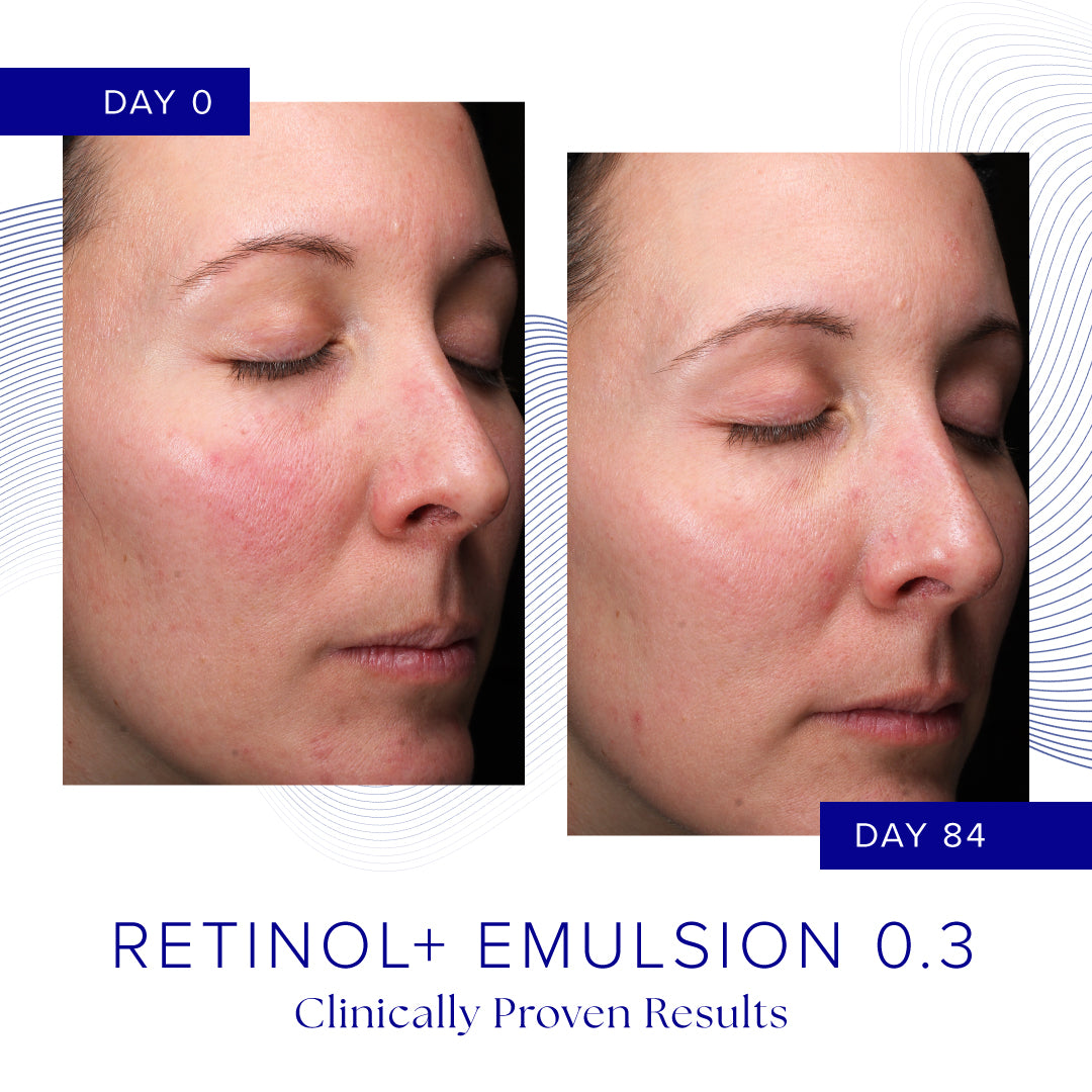 Retinol+ Emulsion 0.3 fra IS Clinical - Avanceret anti-aging hudplejeprodukt med 0,3% retinol der reducerer fine linjer, forbedrer hudtekstur og giver en jævn hudtone.