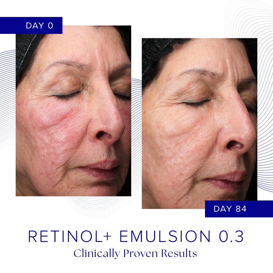 Retinol+ Emulsion 0.3 fra IS Clinical - Avanceret anti-aging hudplejeprodukt med 0,3% retinol der reducerer fine linjer, forbedrer hudtekstur og giver en jævn hudtone.