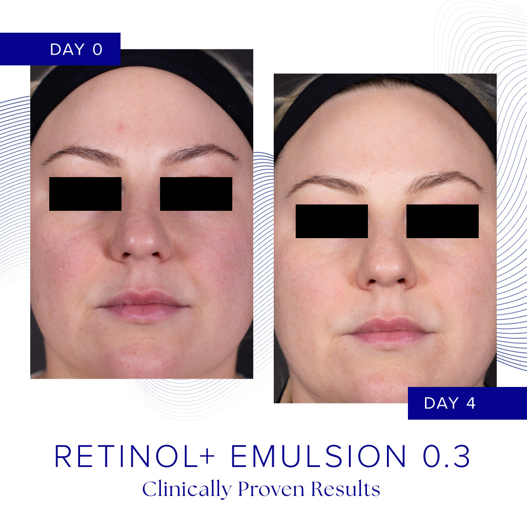Retinol+ Emulsion 0.3 fra IS Clinical - Avanceret anti-aging hudplejeprodukt med 0,3% retinol der reducerer fine linjer, forbedrer hudtekstur og giver en jævn hudtone.