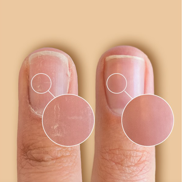 CND neglebåndsolie lille størrelse effekt