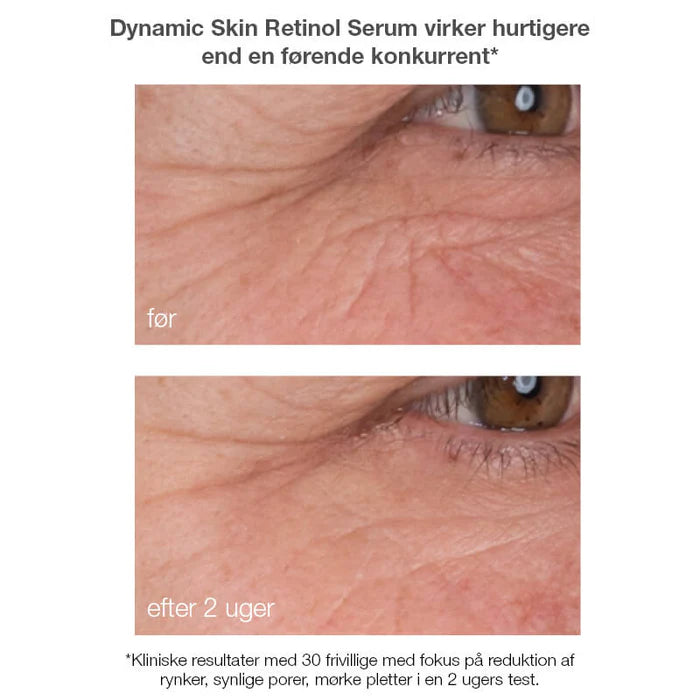 Dynamic skin retinol serum