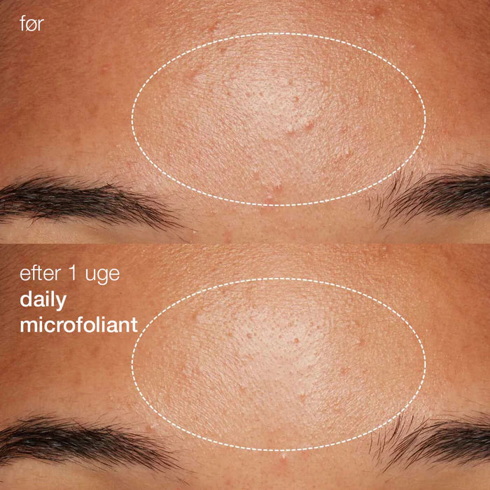 Daily Microfoliant